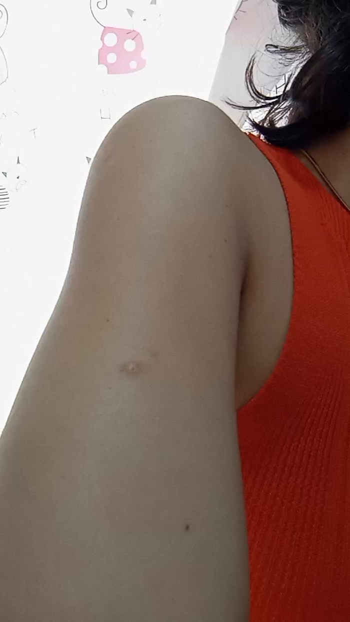 LaLiceale5
