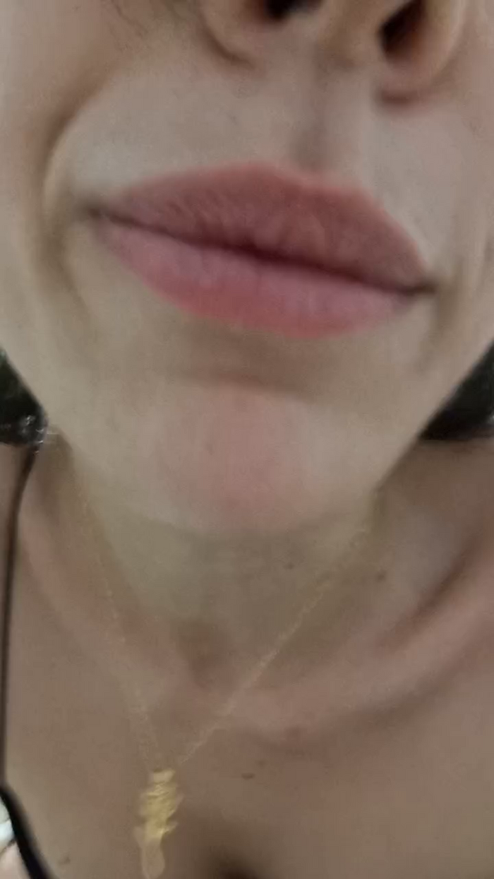 LaLiceale5