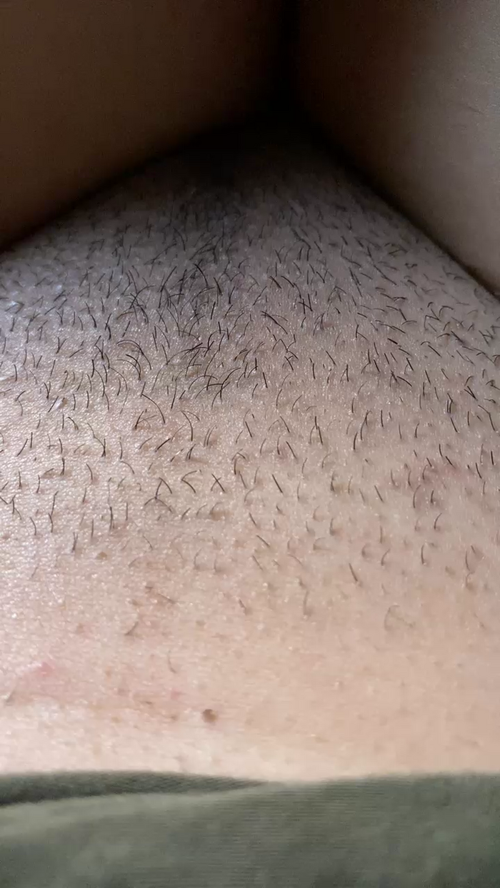 fire_lili
