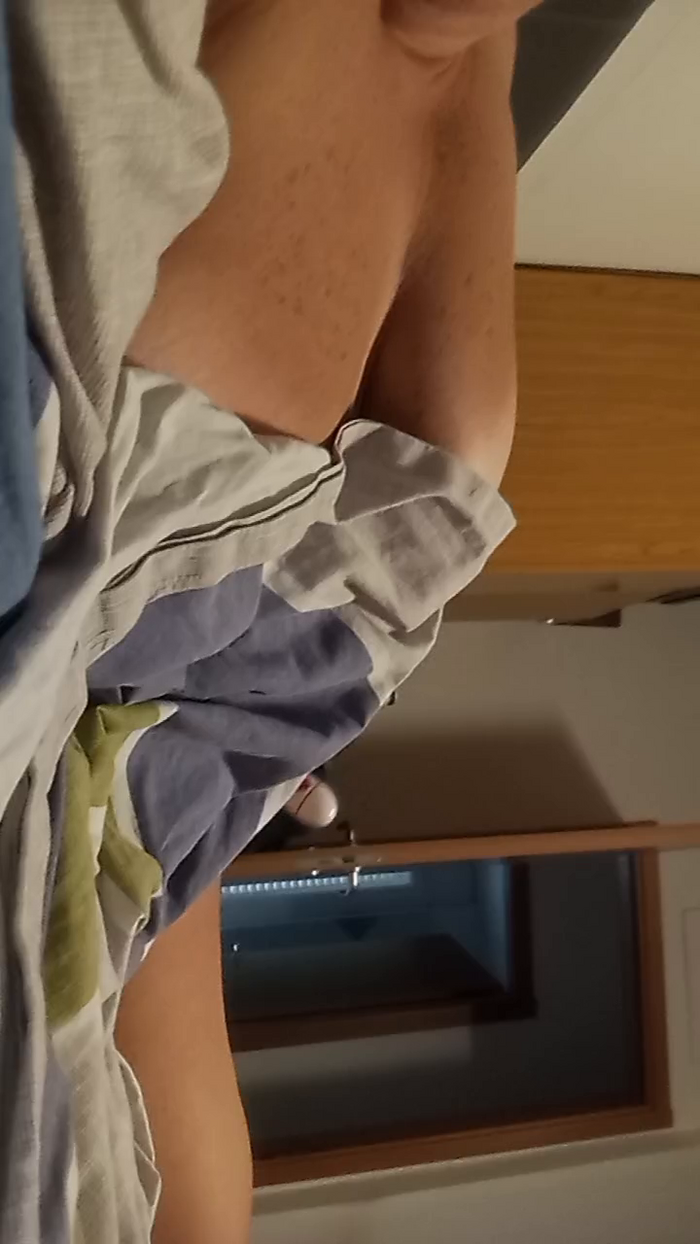 Scopami5