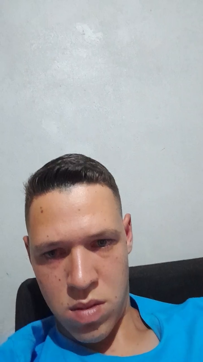 PackChamadas