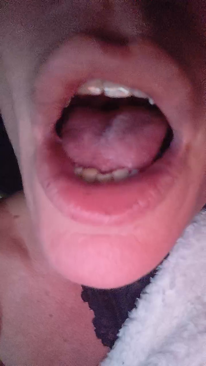 Hotledy69