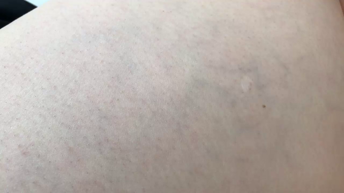 Riinapussy