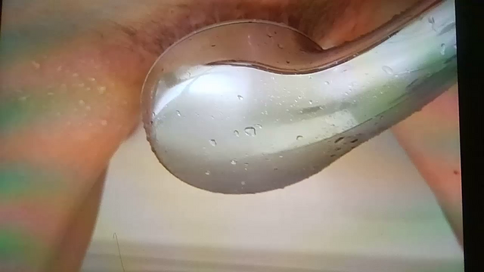 yakirinngo