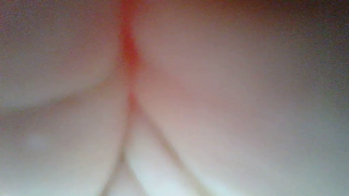 _CURLYPERI__