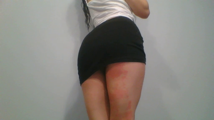 _CURLYPERI__