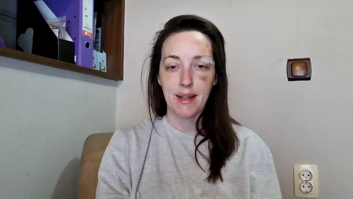 PaleBlueEyesOGxx