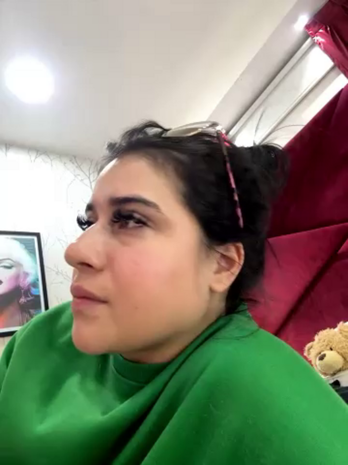 KallyMyller1