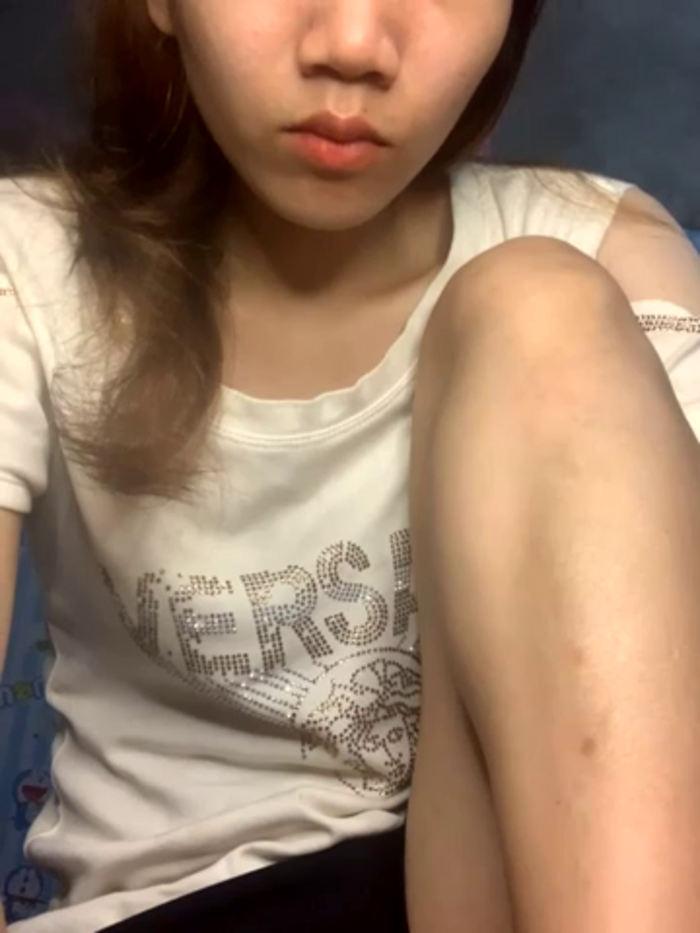 Any_224