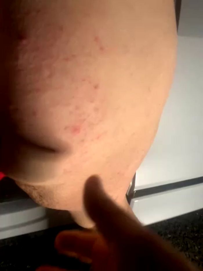 redxxxvixen