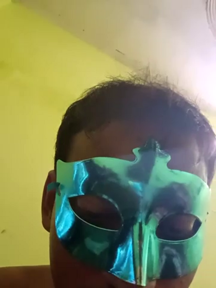 PalpatedCrimp
