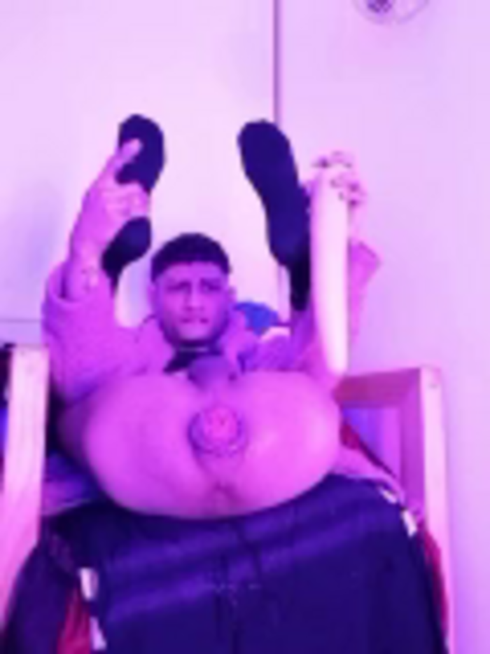 yoerthotx