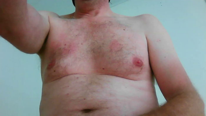 papiculo86