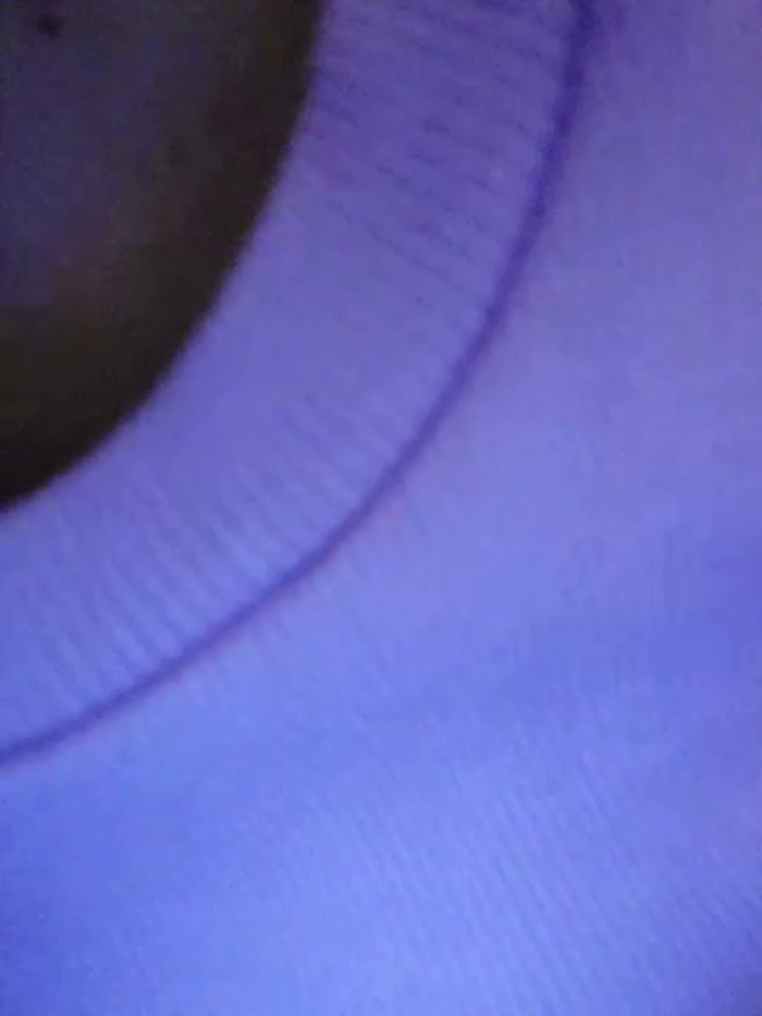 dalo3aa11