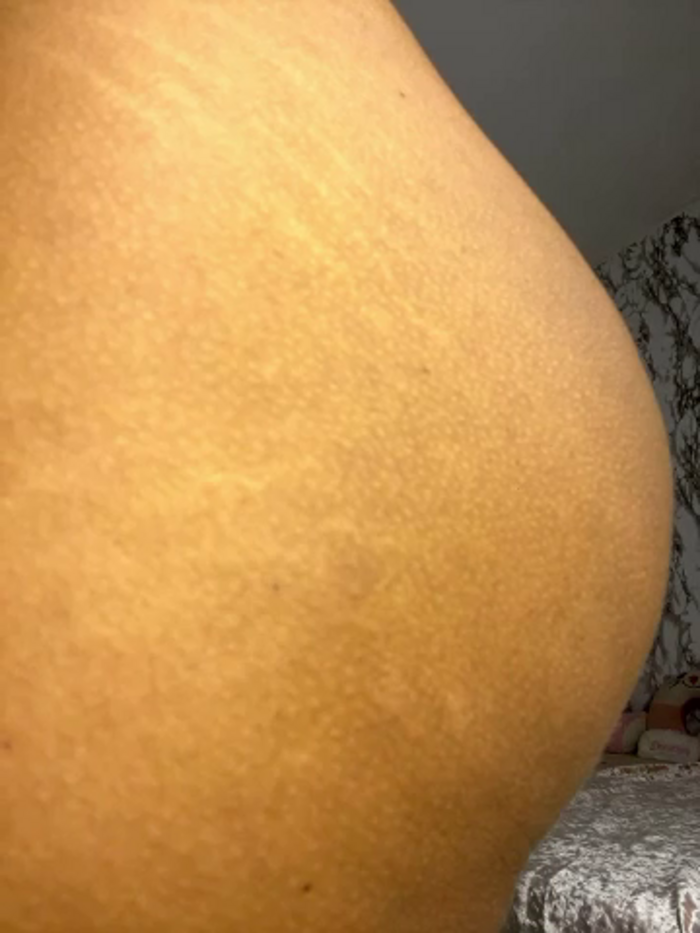 Gerallima_1