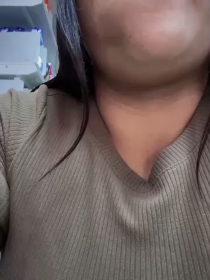 Sol_biglips