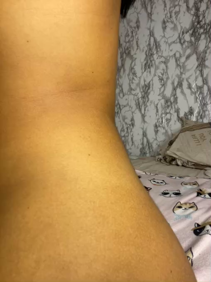 Gerallima_1