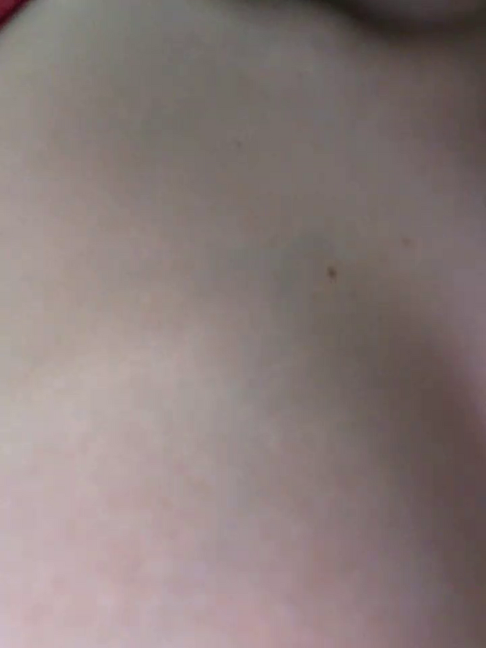 Aome_01