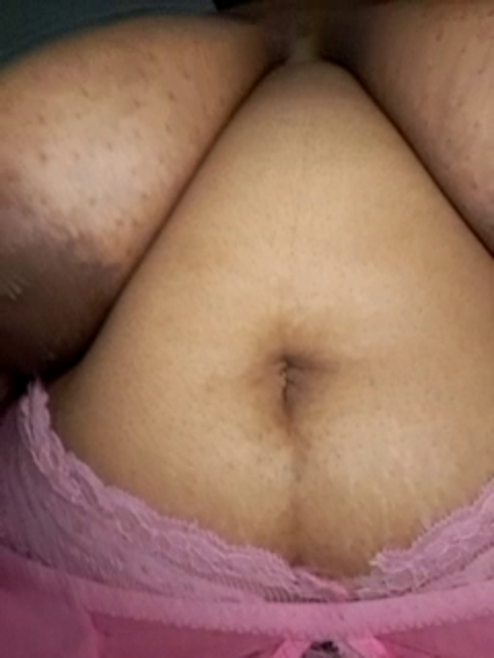 thicktash