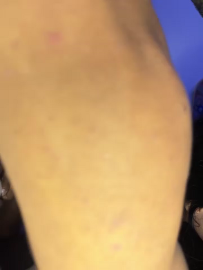 Candyperry