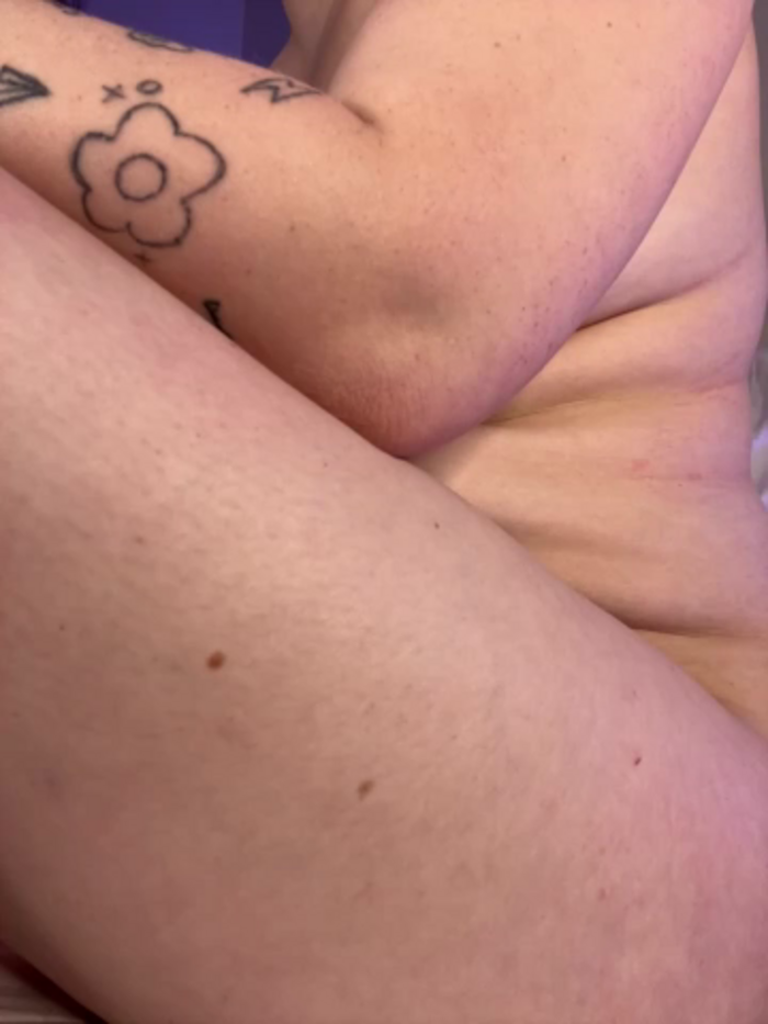 Anal_Top