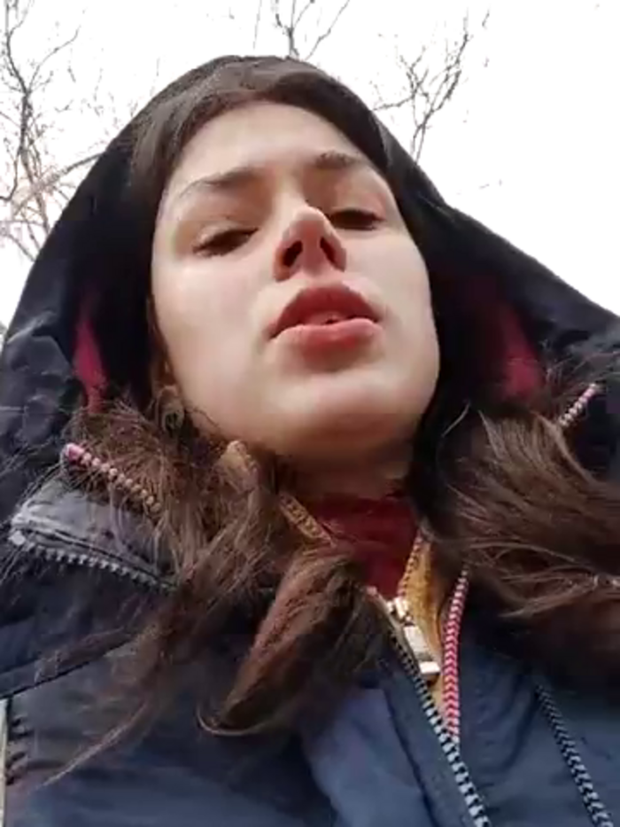 honeykissalips34
