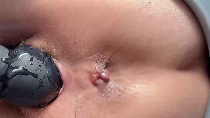 Krismil3