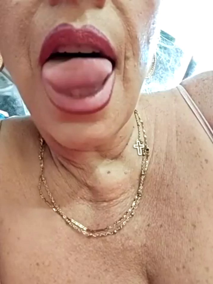 Lossexycacha