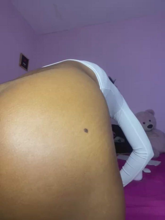 Gerallima_1
