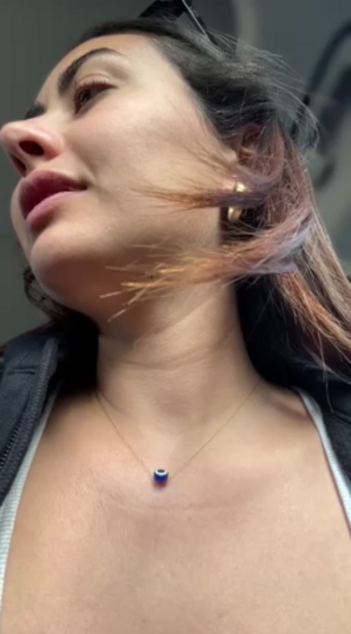 ximenacazalla