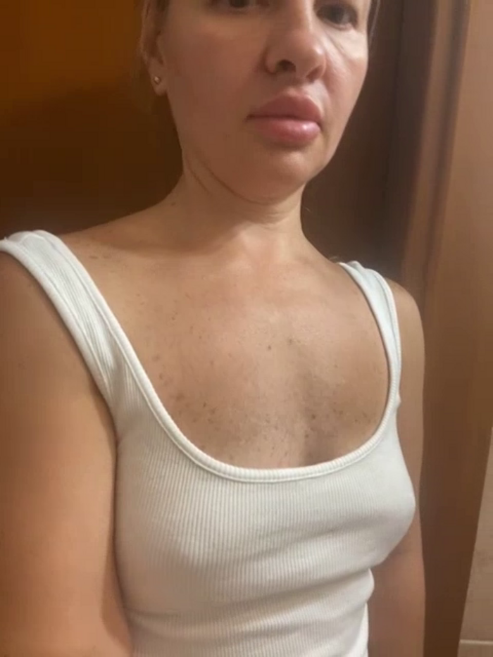DinaXKisa